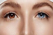 خطرهای عمل تغییر رنگ چشم برای افراد سالم