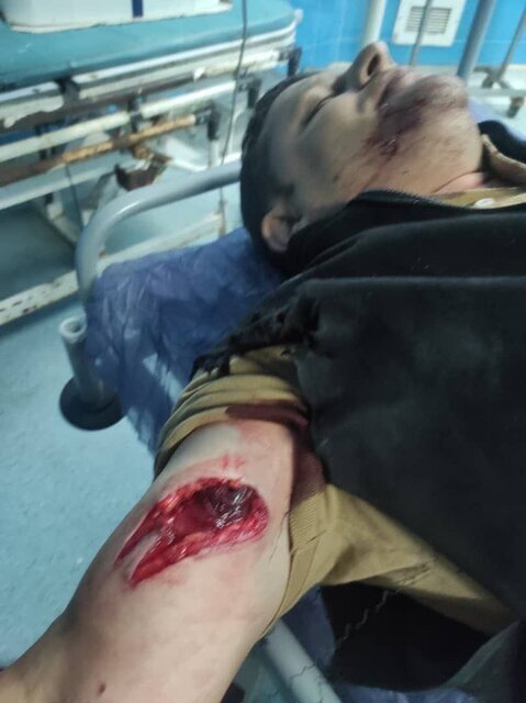 حمله به یک جنگلبان با اره موتوری روشن + عکس