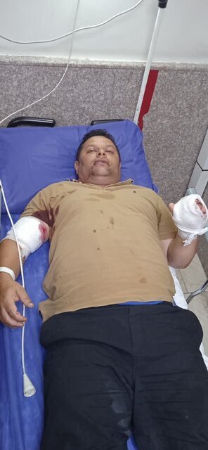 حمله به یک جنگلبان با اره موتوری روشن + عکس