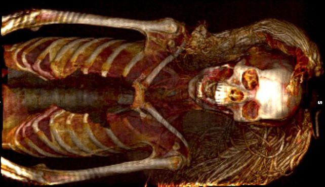 معمای تلخ مومیایی زن جیغ‌کش مصر باستان برملا شد