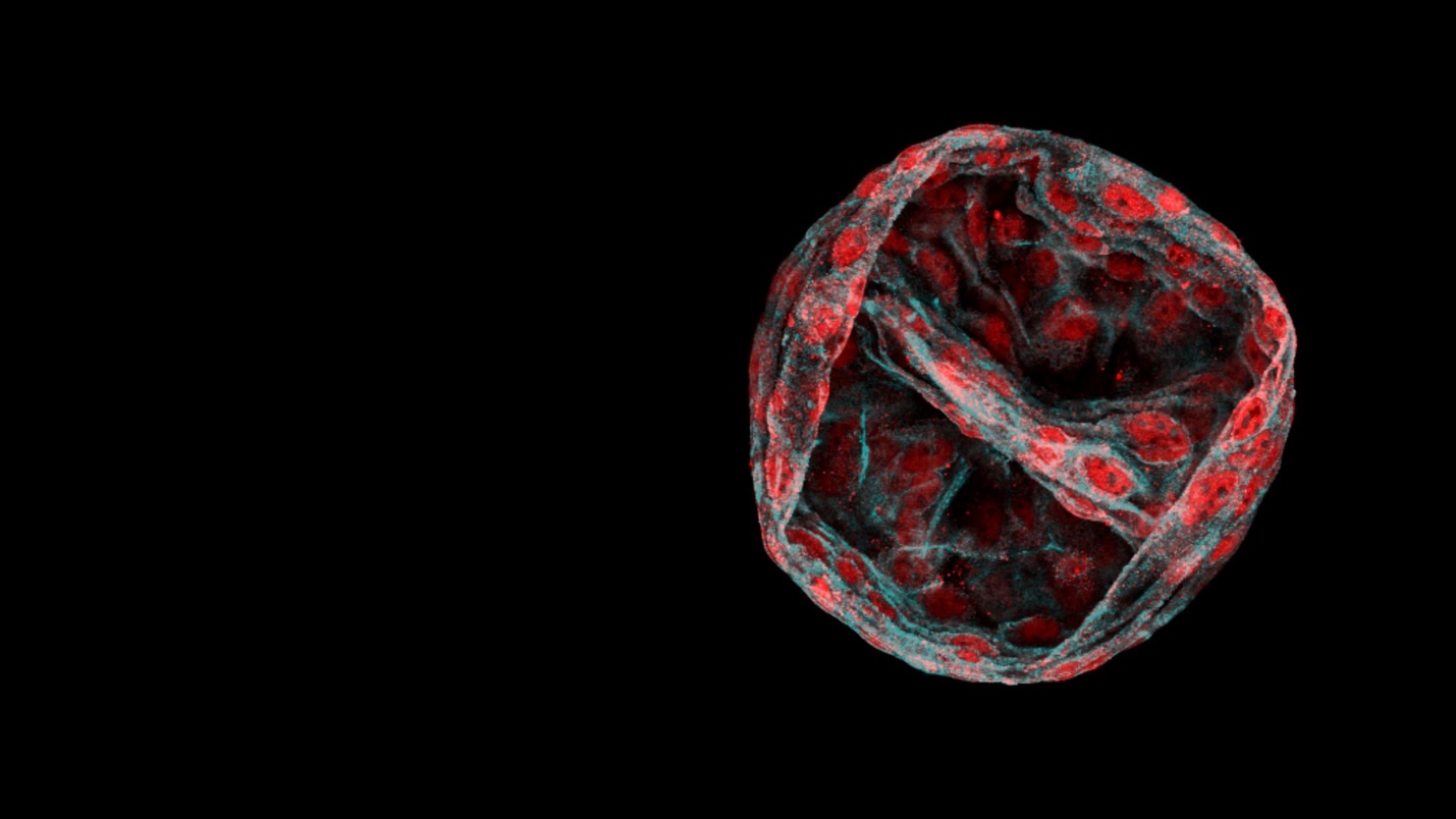 بهترین تصاویر علمی 2024 به انتخاب نیچر / ۲ ایرانی محقق در فهرست بهترین‌ها