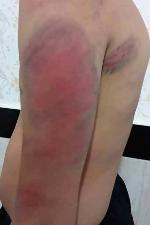 ضربوشتم دانشآموزان توسط معلم در کرجو سنندج + عکس