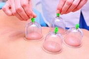 بادکش درمانی چیست و چه مزایایی دارد؟