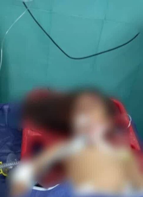 حمله سگ به دختر بچه ۶ ساله در رفسنجان