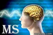 ۱۰ نشانه خاموش بیماری ام‌اس