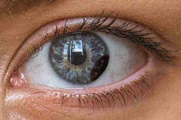 تحول در درمان ملانومای چشمی