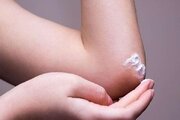 رفع تیرگی زانو و آرنج با بهترین روش‌های خانگی