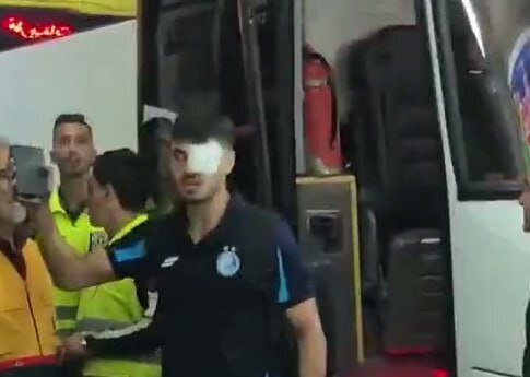 ستاره گرانقیمت استقلال: چشمم دیگر نمی‌بیند! + عکس