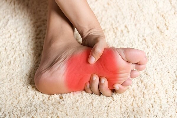 داغ شدن کف پا نشانه چه بیماری‌هایی است؟