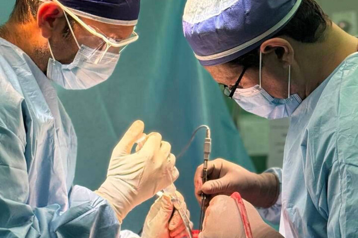 خروج موفق تومور مغزی ۱۲۰ گرمی توسط جراح مغز و اعصاب بیمارستان بهلول