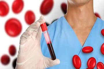 علت کم‌خونی فقر آهن چیست؟