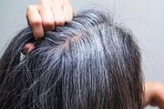 ۶ روش علمی برای به تاخیر انداختن سفیدی موها