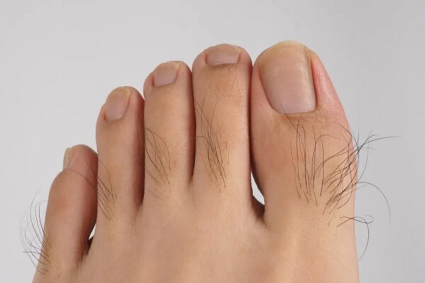 تراکم موی انگشت پا از کدام راز سلامت بدن خبر می دهد؟! تراکم موی انگشت پا از کدام راز سلامت بدن خبر می دهد؟!