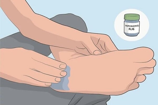 نکات بهداشتیِ مراقبت از پا در فصل گرما