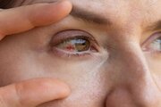 چه عواملی باعث پارگی رگ خونی در چشم می‌شوند؟