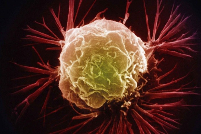 نابودی سلول های سرطانی توسط نارنجک‌ میکروسکوپی  