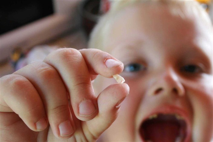 ترمیم دندان کودکان با سلول‌های بنیادی