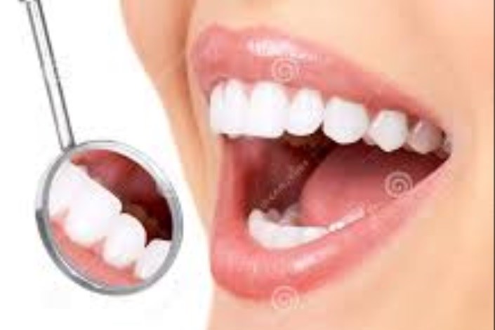 اختصاص 150 میلیارد تومان اعتبار به بخش دهان و دندان در سال گذشته