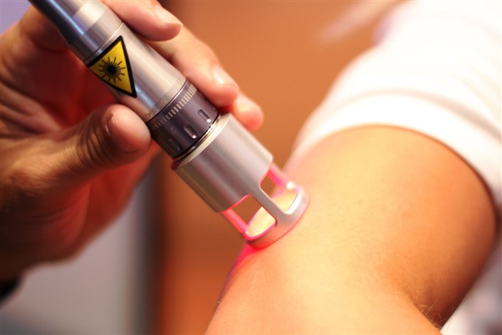 استفاده از لیزر برای پیشگیری از بروز زخم‌ها
