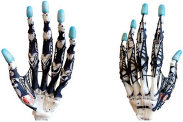  دست مصنوعی با فناوری چاپ سه‌بعدی