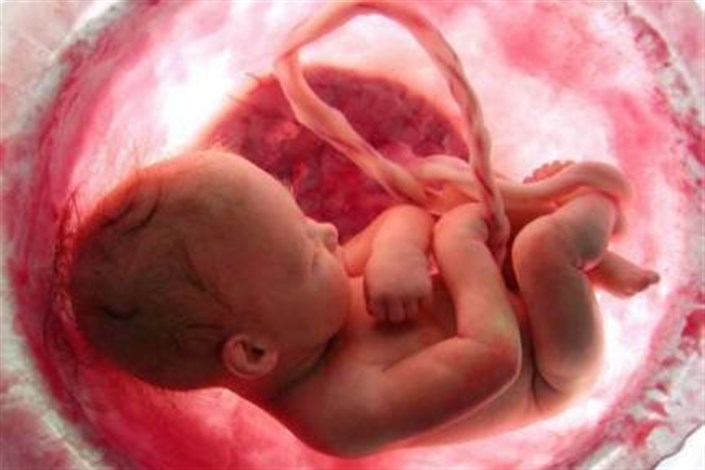 امکان تشخیص بیشتر ناهنجاری‌های مادرزادی در دوران جنینی به وسیله سونوگرافی