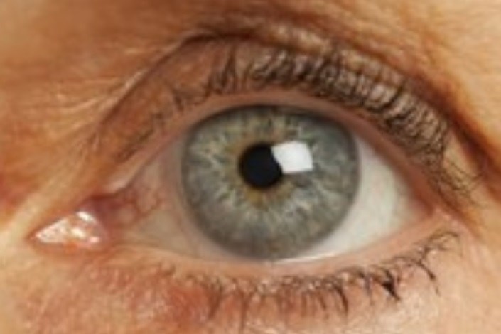 آب سیاه دومین علت نابینایی/ مهم ترین علت ابتلا به گلوکوم