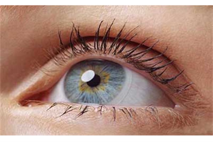 خطرات استفاده از لنزهای غیراستاندارد