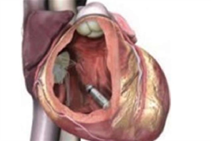 محققان آمریکایی موفق به ساخت قلب مصنوعی شدند