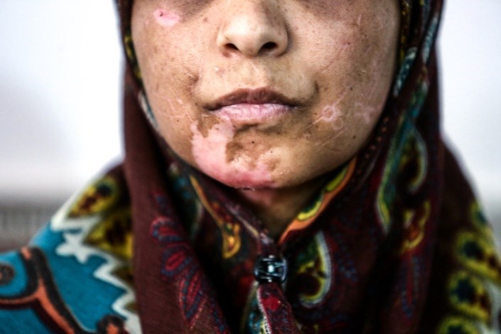تصاویرشکنجه 21 روزه زن بی پناه/او و دخترانش 21 روز غذا نخوردند اما هنوز زنده‌اند
