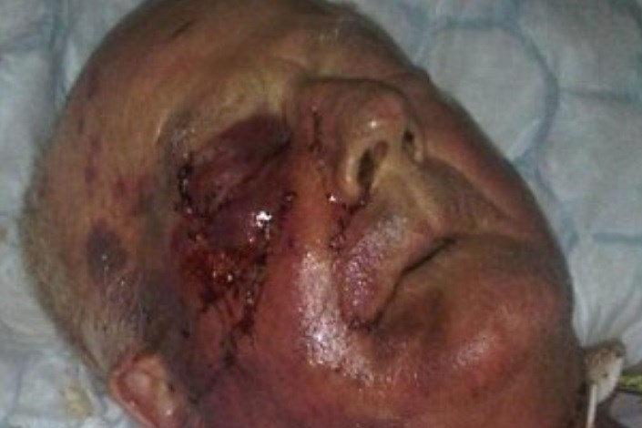 قتل پیرمرد 80 ساله بخاطر اسکناس/ پلیس:صورت پیرمرد قسمتی از صحنه جرم است!/تصاویر