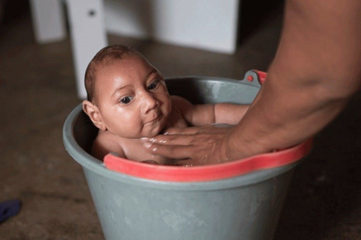 نوزادان آلوده به ویروس زیکا دچار مشکلات بینایی هستند