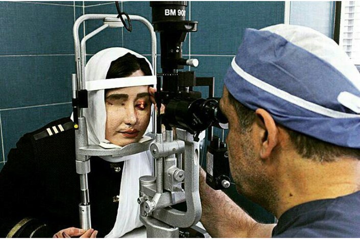 وزیر بهداشت بعد از معاینه چشمان سهیلا قربانی اسید پاشی: روند درمانی چشمان او خوب بوده است