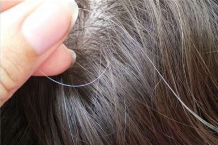 سفید شدن مو در سن زیر 40 سال بیماری است/چند گیاه دارویی که ریزش مو را کاهش می دهند 