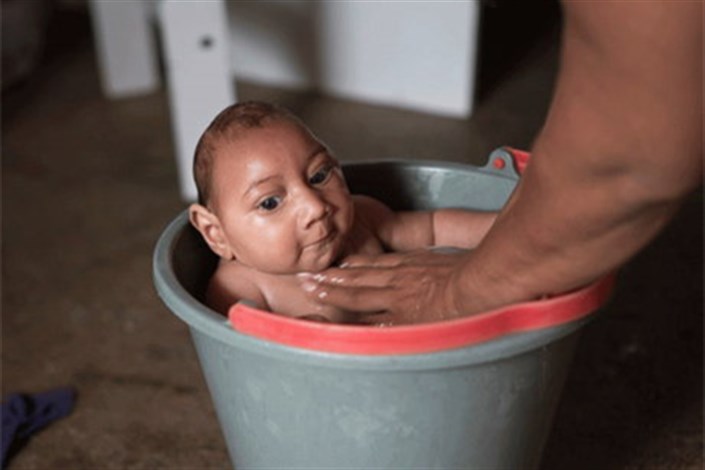  اولین نوزاد مبتلا به میکروسفالی در نیویورک به دنیا آمد