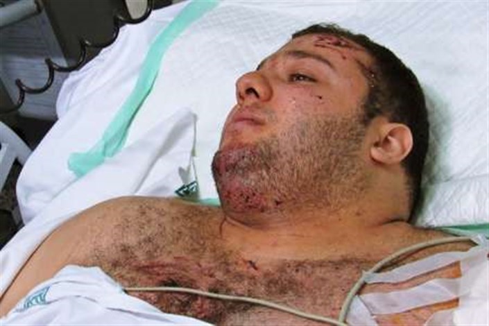 ملی پوش وزنه برداری امروز جراحی می شود