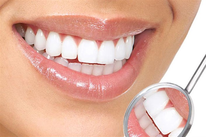 دندانهایتان را برای لبخند زیبا تراش ندهید
