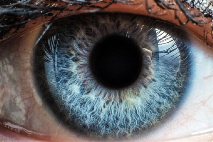 تشخیص زودهنگام پارکینسون به کمک آزمایش چشم