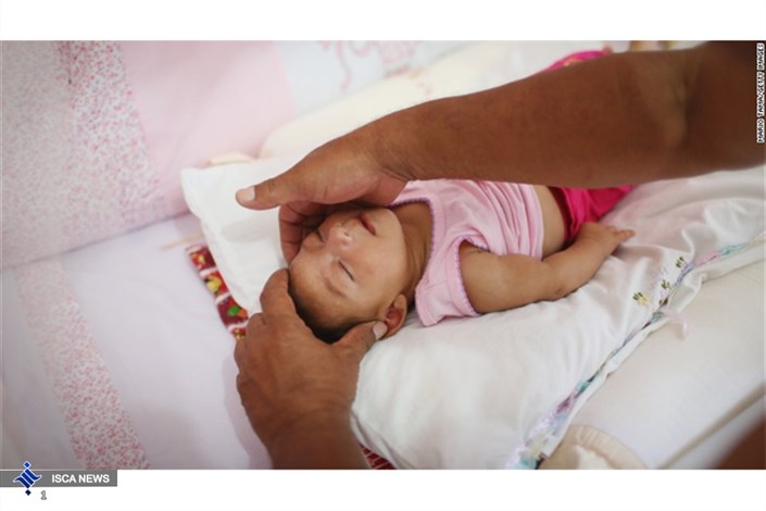 4 نوزاد تایلندی مشکوک به میکروسفالی ناشی از زیکا تشخیص داده شدند