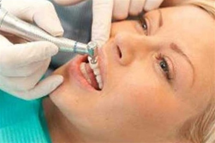 سفید کردن دندان‌ها درمان دائمی آن   نیست/دندان سفیدم آرزوست