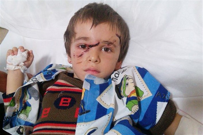   گرگ 10 کودک را در یک روستای تبریز زخمی کرد