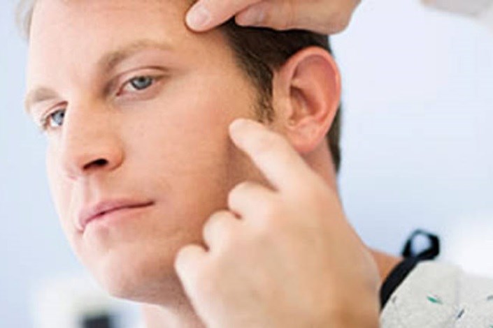 5 نشانه کمبود مواد مغذی در چهره شما 