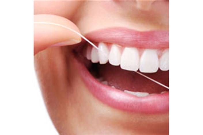 رعایت بهداشت دهان و دندان منجر به بقای عمر روکش دندانی می شود