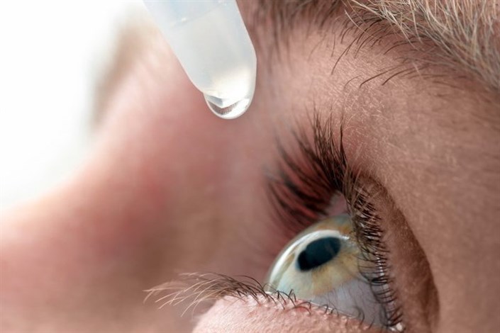 قطره های چشم را خودسرانه مصرف نکنید/ آلرژی های چشمی در هوای آلوده ایجاد می شود