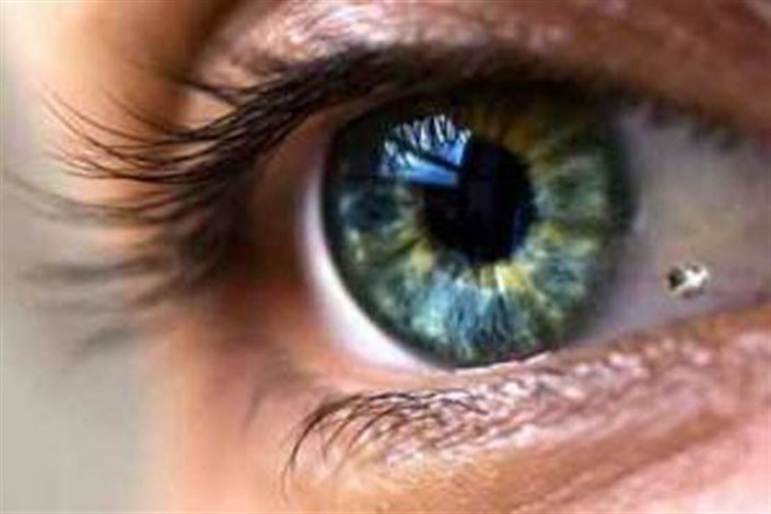 خطر تخلیه و نابینایی  با تغییر رنگ چشم /  مد زیبایی کاشت نگین و تغییر رنگ چشم