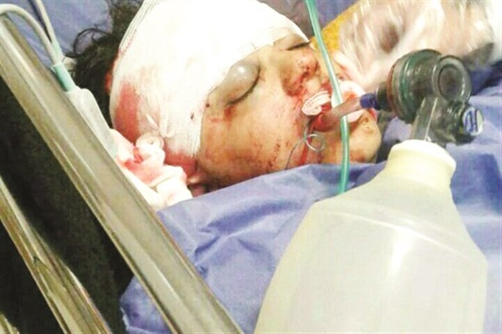  بخشش پلان آخر زندگی  سلیمه/اعضای بدن عروس فسایی به ٥ بیمار در بیمارستان نمازی شیراز اهدا شد