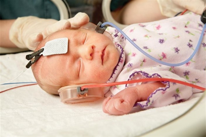 سالانه 4 تا 5 هزار نوزاد کم شنوا در کشور متولد می شود