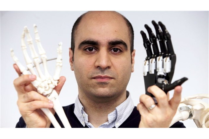 محققان ایرانی دست مصنوعی دوربین دار ساختند