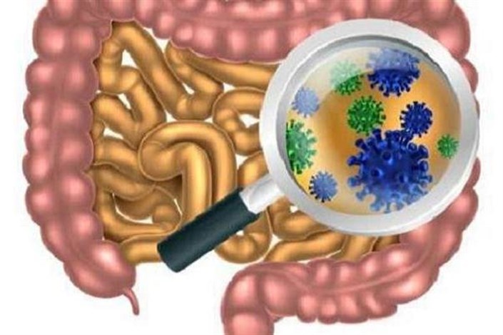 میکروب های روده عامل بروز سندروم خستگی مزمن