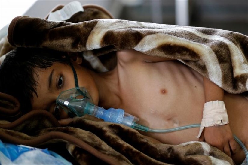 یونیسف: جنگ در یمن، جنگ علیه کودکان است