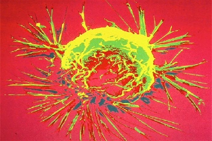 ارائه نقشه جدید سلول سرطانی توسط دانشمندان
